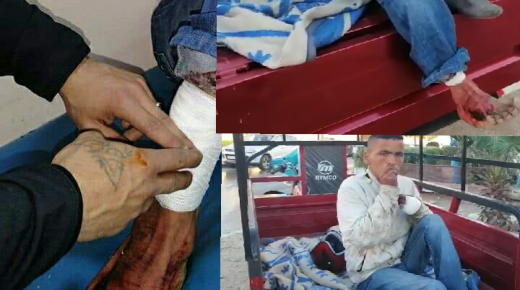 غضب فيسبوكي بعد انتشار فيديو لشاب متشرد بمدينة آزمور تعرض لهجوم كلب من طرف مجهولين